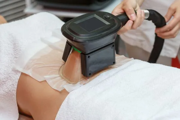 Image of person having fat freezing treatment to help weight gain Gosport