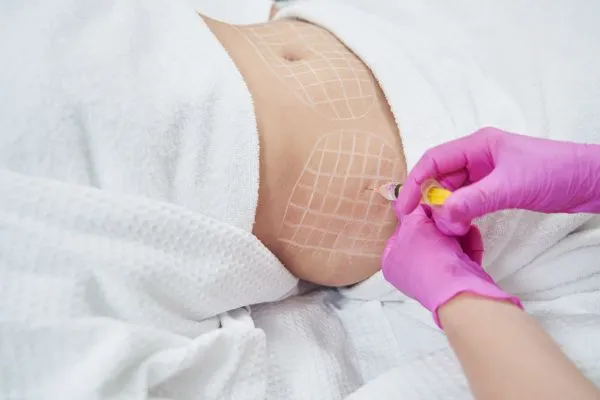 image of fat dissolving injections on love handles to help combat weight gain Gosport