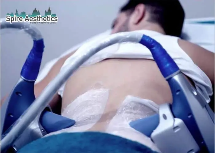 Man having fat freezing treatment done on love handles before a competitions Gosport to create a sculpted look.