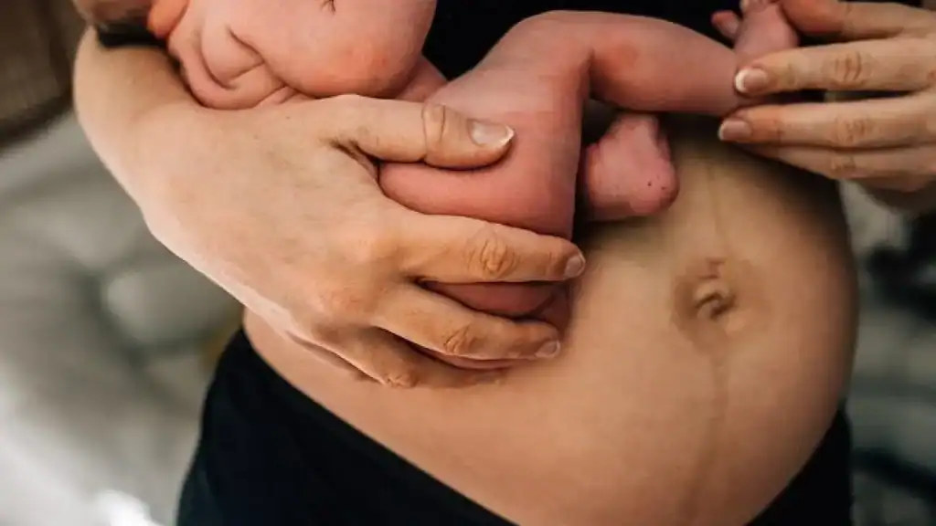 Why Is My Stomach Still Big After Pregnancy Gosport?